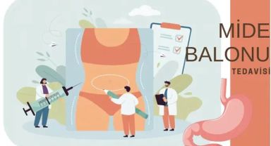 Mide Balonu Nedir?