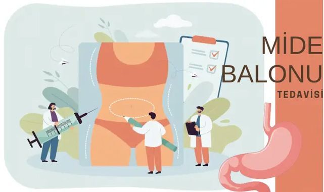 Mide Balonu Nedir?